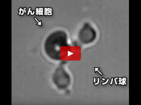 淋巴细胞（免疫细胞）攻击癌细胞的显微镜影像