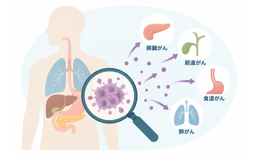 悪性度が高いがんとは？　特徴や種類、治療方法、分化度の基礎知識を解説