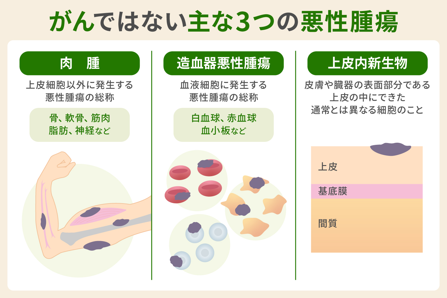 がんではない主な3つの悪性腫瘍