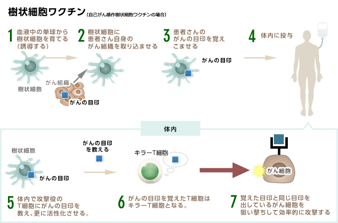 树突状细胞疫苗